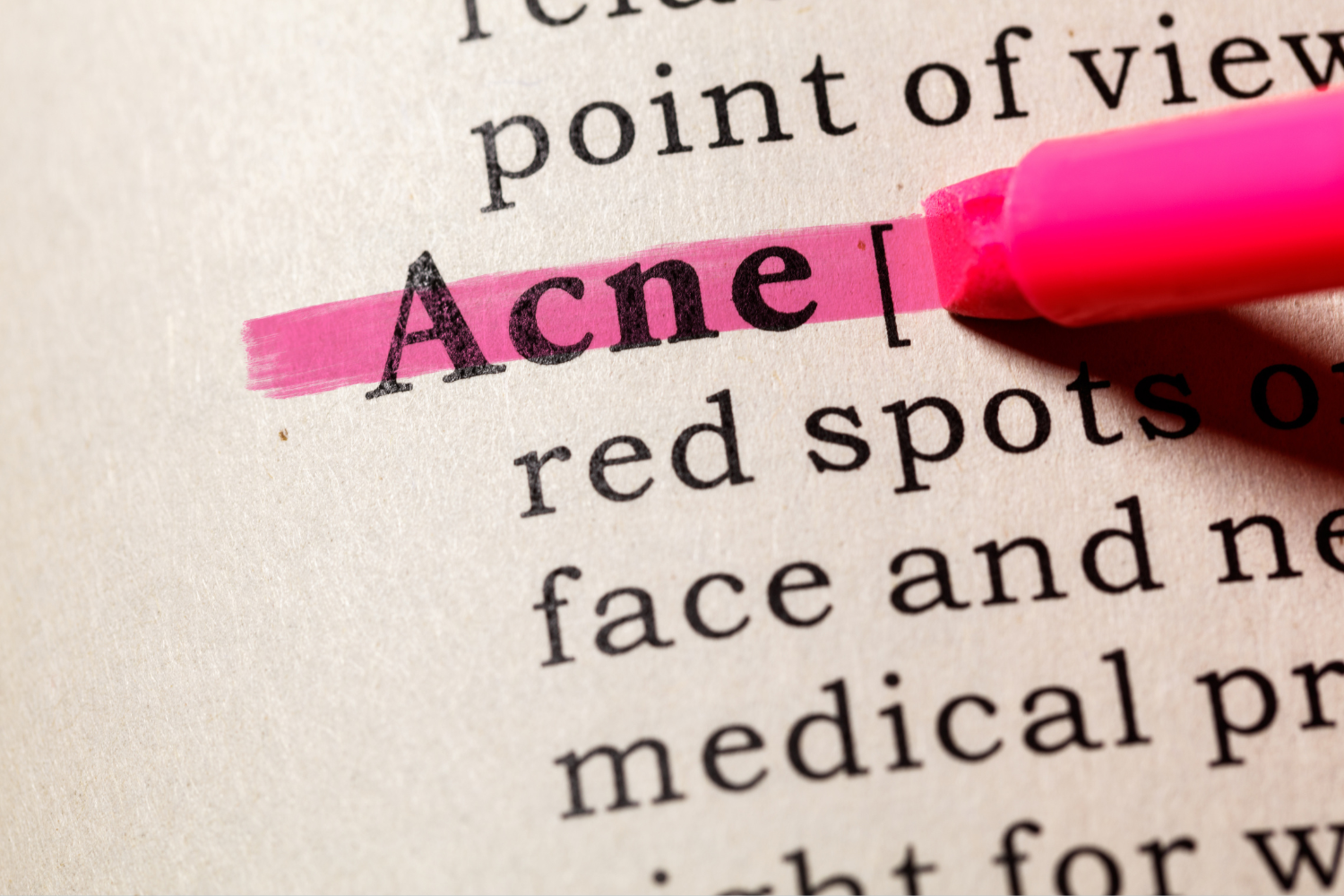 acne highlighted on paper